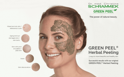 11 συχνές ερωτήσεις για το GREEN PEEL®