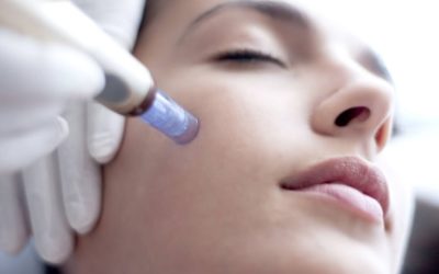 Ετερόλογη Μεσοθεραπεία – Microneedling Dermapen