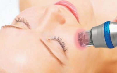 FRF MICRONEEDLING